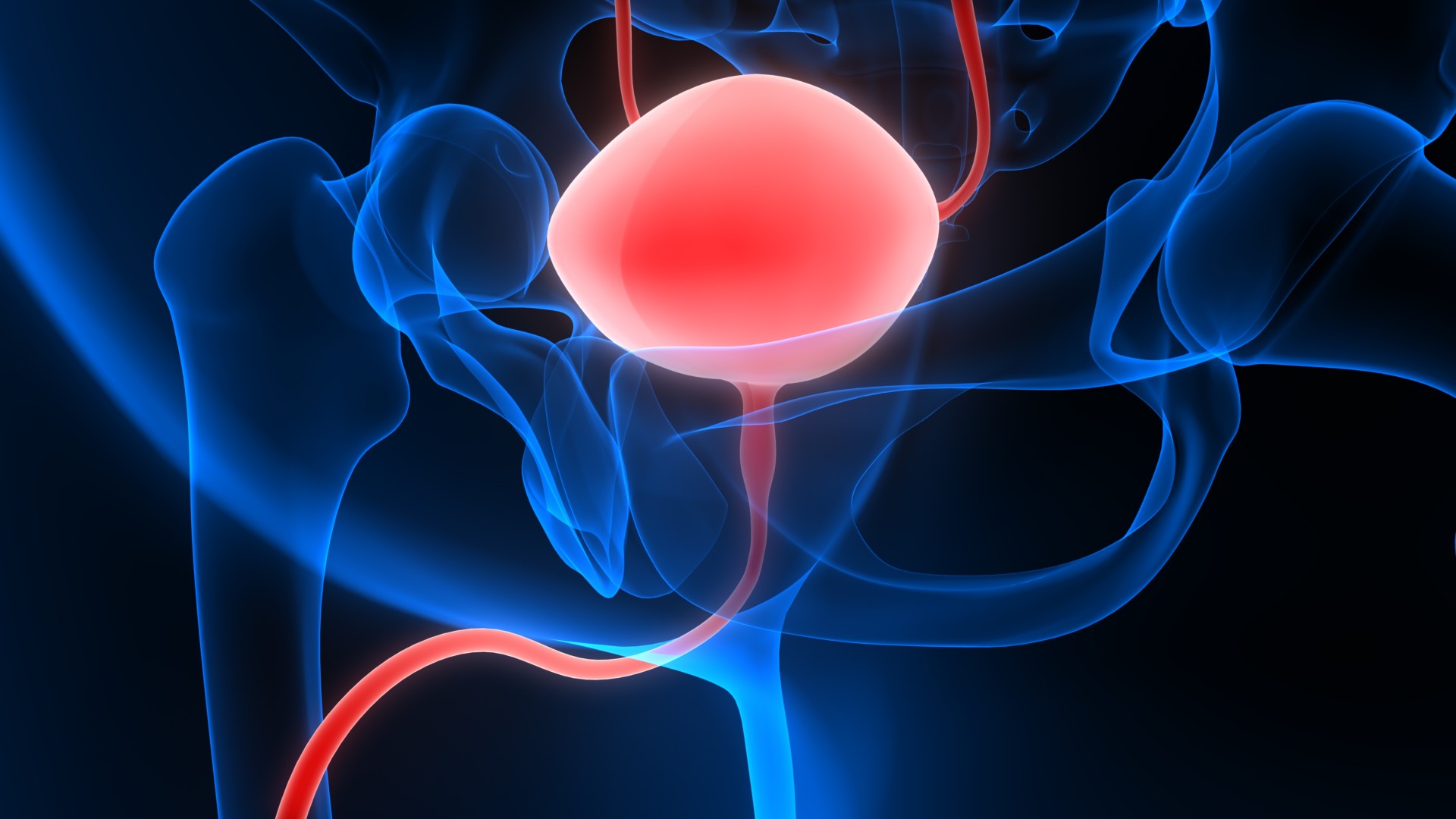Studying a New Therapy for Bladder Cancer Chemoimmunotherapy Response